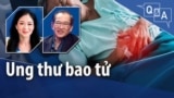 Ung thư bao tử